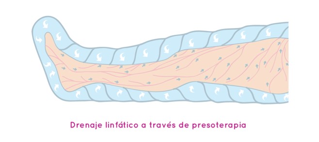 DRENAJE LINFATICO A TRAVES DE LA PRESOTERAPIA