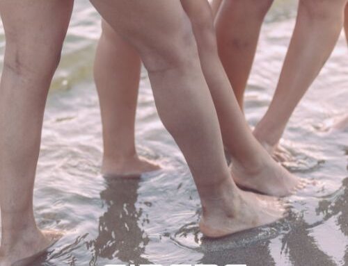 Diferencia entre lipedema y celulitis