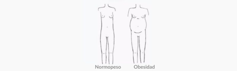 Principales características estéticas morfología nerviosa